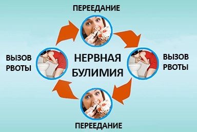 Лечение булимии в Губдене